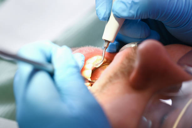 Best Emergency Broken Tooth Repair in Las Vegas, NV
