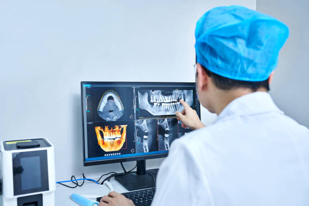 Best Emergency Wisdom Teeth Removal in Las Vegas, NV